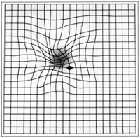 Defeito macular